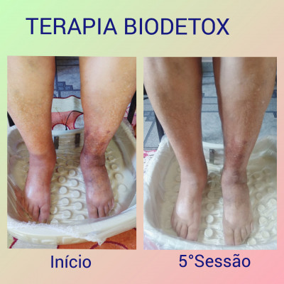 foto Terapia Biodetox